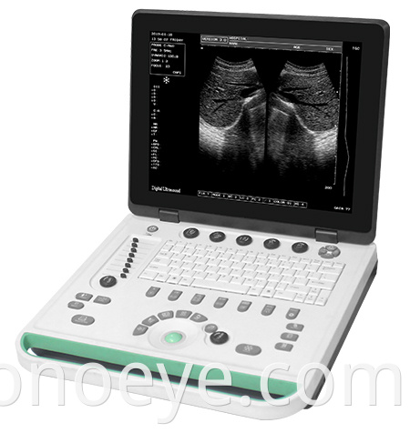  portable ultrasound